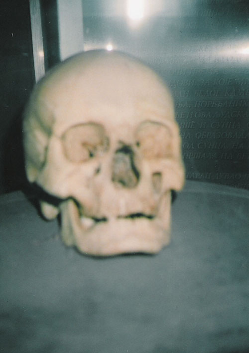 Лобања Стевана Синђелића